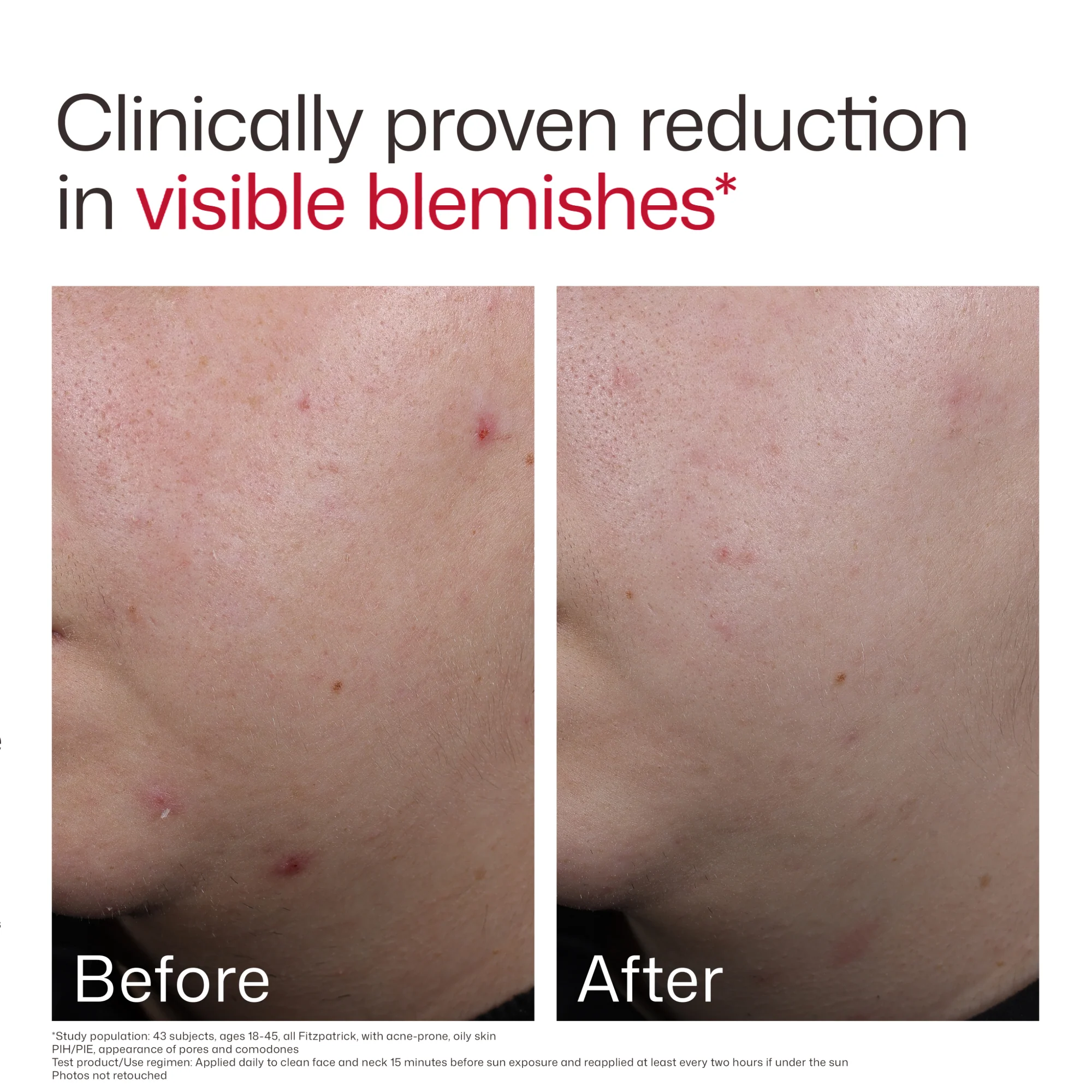 EltaMD UV Clear Blemish-Prone & Oil Balancing SPF 50 - Image 7