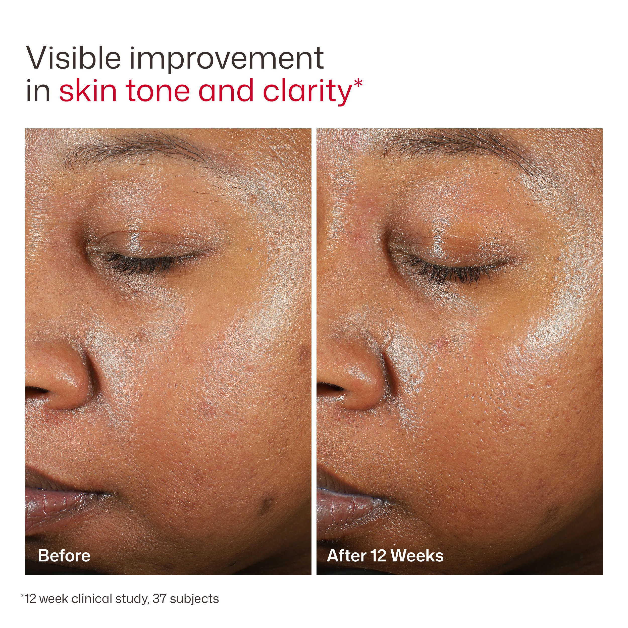 EltaMD UV Clear Broad-Spectrum SPF 46 - Image 9